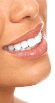 50 Things You Should Know about Dental Implants in Mexico