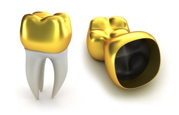 A gold tooth with black and white teeth.