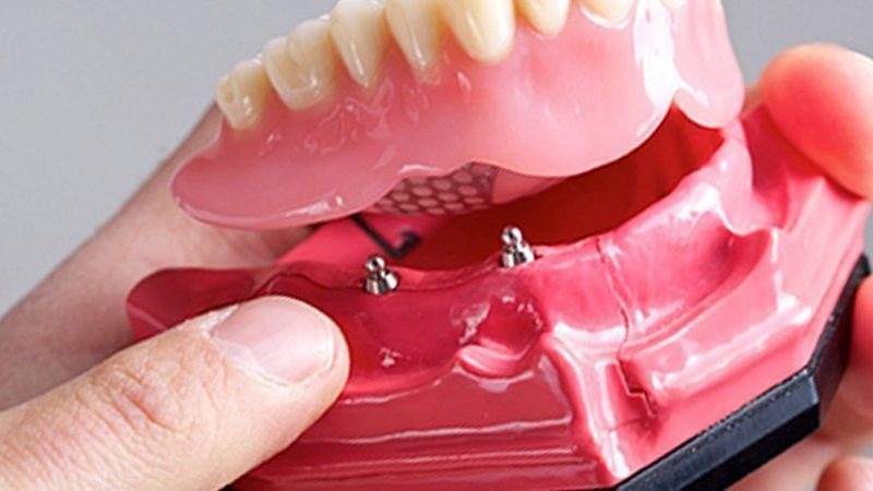 A person is holding onto the teeth of an artificial denture.