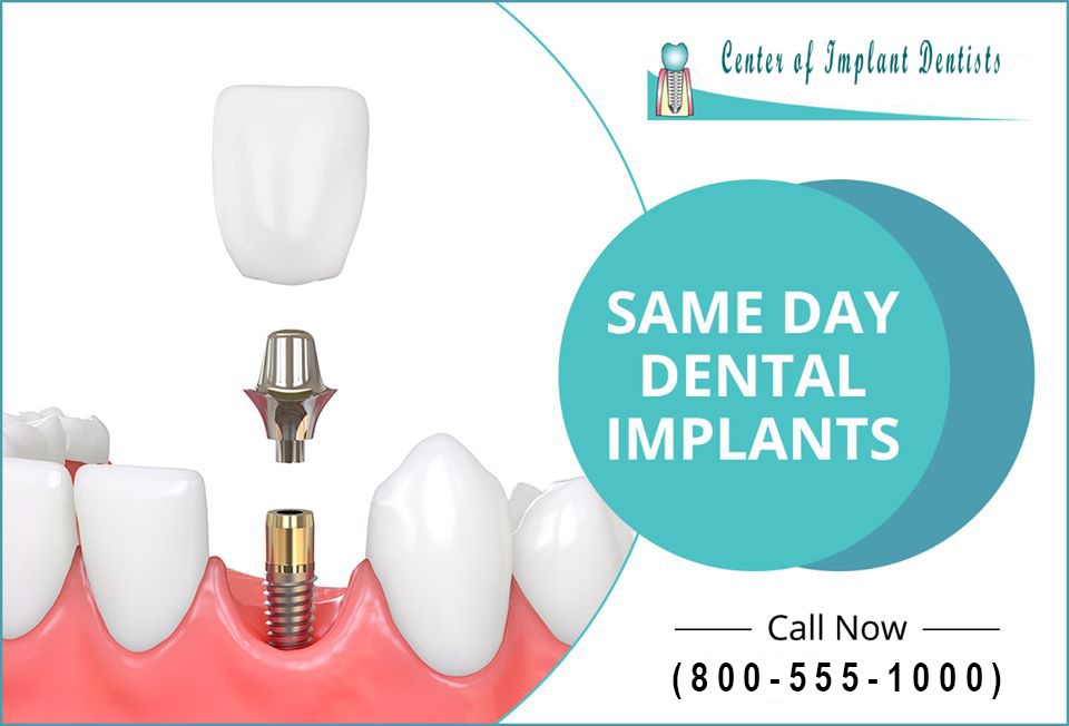 A dental implant advertisement.