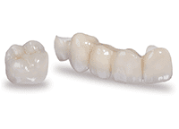 A picture of two different types of dental crowns.