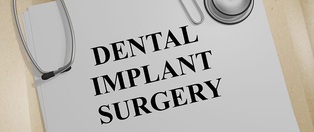 50 Things to Know About Implants