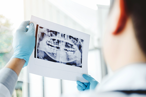 A dentist holding up an x-ray of teeth.