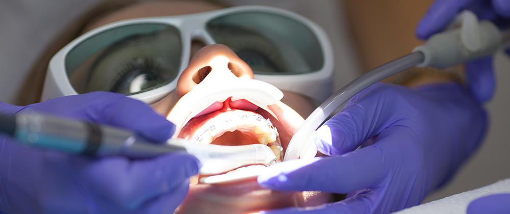 Laser Treatment for Gum Disease