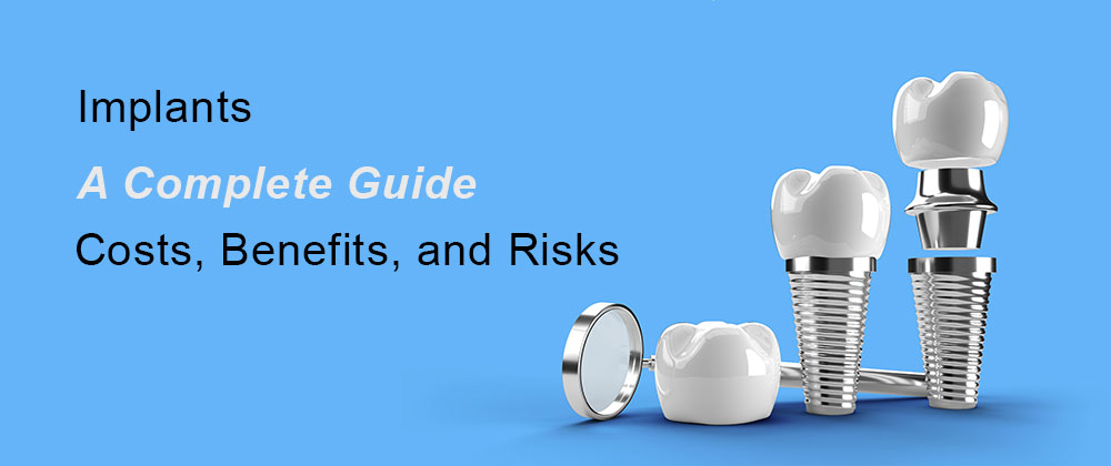 Implants: Costs, Benefits, and Risks