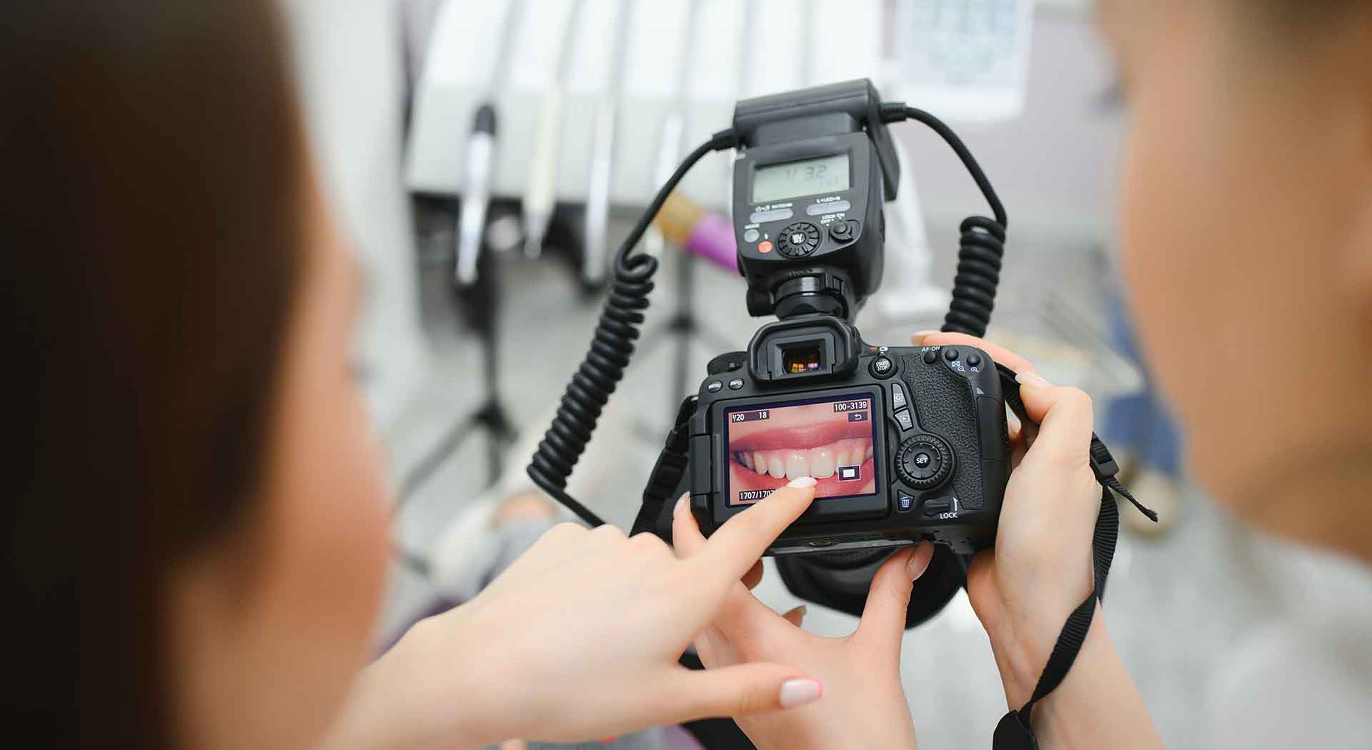 Before and after pictures of dental patients in Mexico